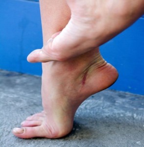 broken-foot2
