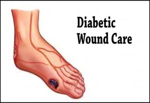 diabetic-wound-care