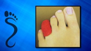 broken toe