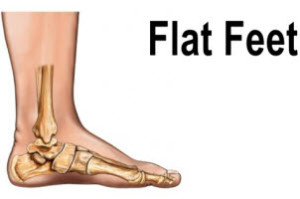 running flat footed