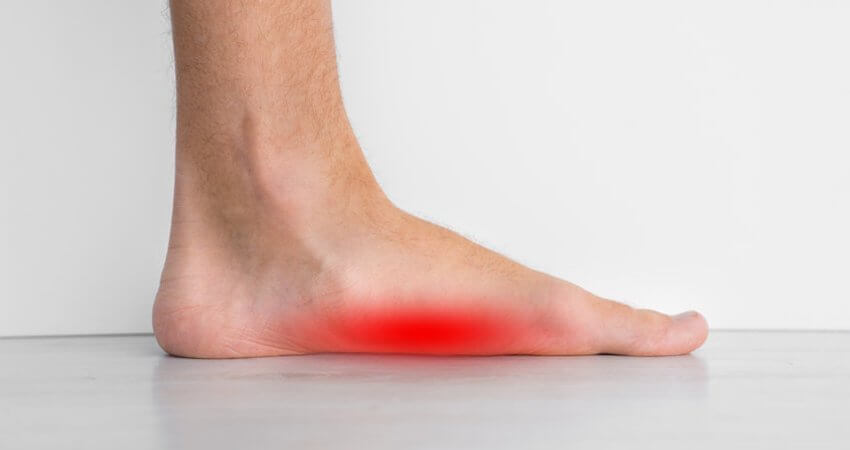 Flat Foot Symptoms and Diagnosis