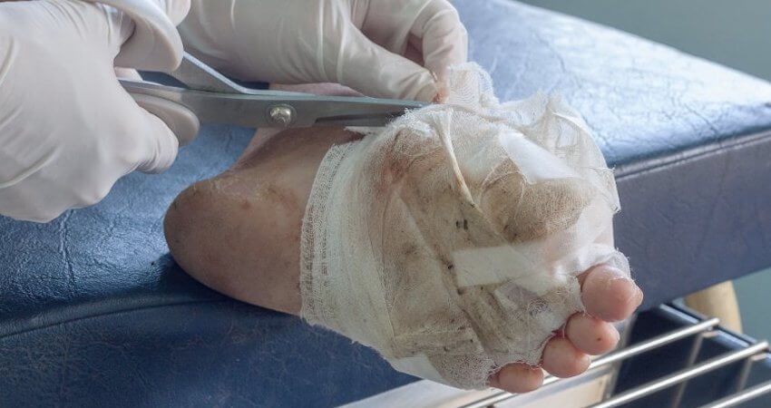 Diabetic Foot Care