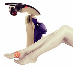 laser fixes foot pain