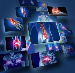 laser pain treatment