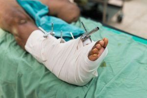 foot pain management