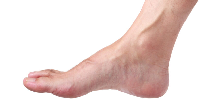 ganglion cyst on your foot