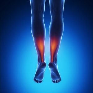 Achilles Tendon Pain