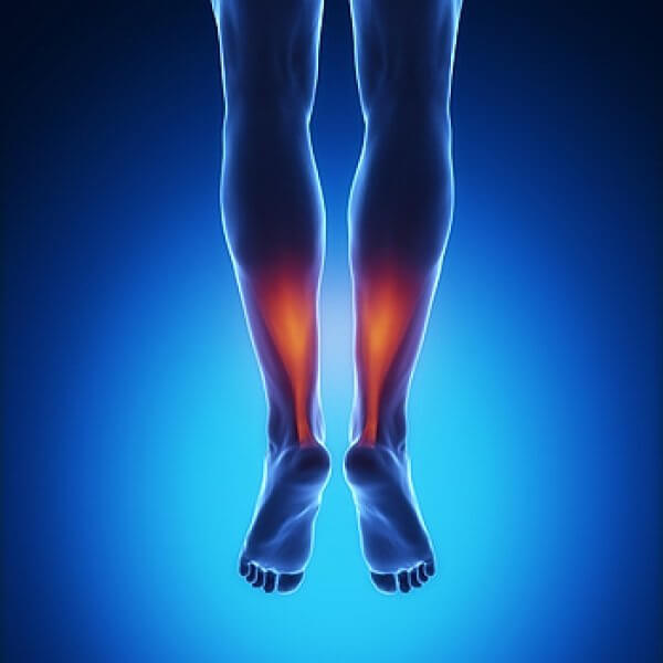 Achilles Tendon Treatments Foot HealthCare Associates