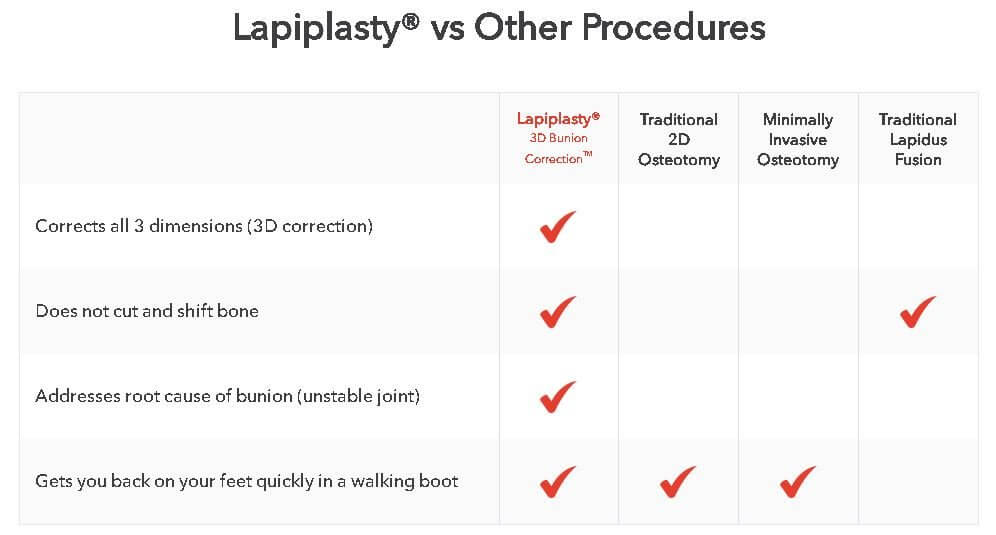 bunion surgery- lapiplasty